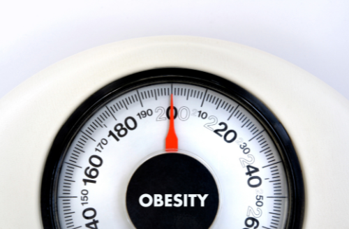 Visualizing the Impact of Childhood Obesity: A Growing Global Concern